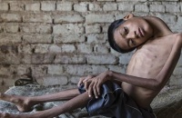 印度13岁男孩天生头部朝下父母想其安乐死 结果……